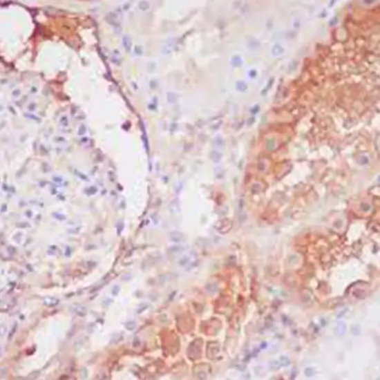 C9 Complement Component Test